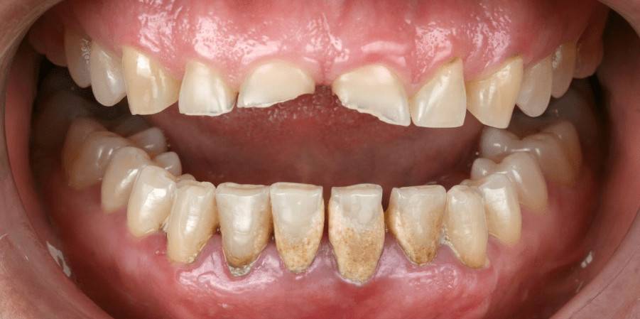 Before image
